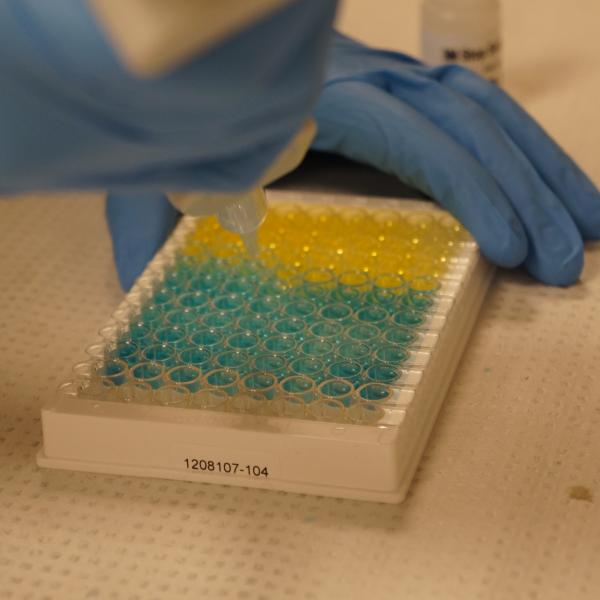 Biomarker Lab Work